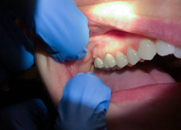 Best Emergency Root Canal Treatment in Moyock, NC