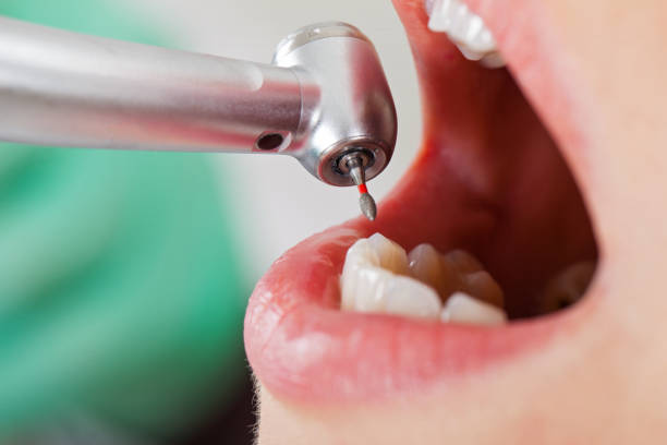 Best Emergency Dentist for Special Needs Patients in Moyock, NC